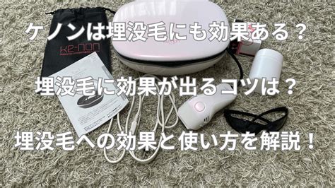 脱毛器 剃らずに|ケノンは毛を剃らずにOK？毛が長いままでもいいか実際に使っ。